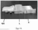 Fig. 30 - TOTAL ANKLE REPLACEMENT WITH ANATOMICALLY FITTED TALAR COMPONENT