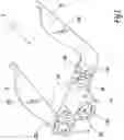 Fig. 02 - Surgical method and instrumentation assembly for positioning an ankle prosthesis