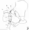 Fig. 04 - Surgical method and instrumentation assembly for positioning an ankle prosthesis
