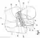 Fig. 05 - Surgical method and instrumentation assembly for positioning an ankle prosthesis