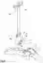 Fig. 06 - Surgical method and instrumentation assembly for positioning an ankle prosthesis