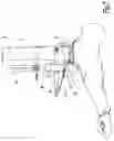 Fig. 08 - Surgical method and instrumentation assembly for positioning an ankle prosthesis