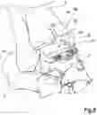 Fig. 09 - Surgical method and instrumentation assembly for positioning an ankle prosthesis