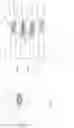 Fig. 06 - Apparatuses and methods for milling bone