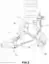 Fig. 03 - Foot prosthesis comprising a damping element