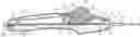 Fig. 01 - Rotary handle stent delivery system and method