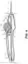 Fig. 05 - Rotary handle stent delivery system and method