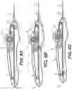 Fig. 07 - Rotary handle stent delivery system and method