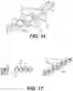Fig. 14 - Rotary handle stent delivery system and method
