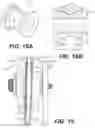 Fig. 15 - Rotary handle stent delivery system and method