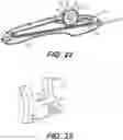 Fig. 17 - Rotary handle stent delivery system and method