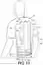 Fig. 14 - BACK SUPPORT DEVICE