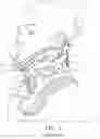 Fig. 02 - Cervical collar having height adjustment