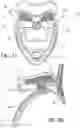 Fig. 03 - Cervical collar having height adjustment