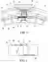 Fig. 05 - Cervical collar having height adjustment