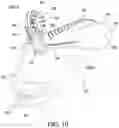 Fig. 10 - Cervical collar having height adjustment
