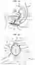 Fig. 02 - Protective Sheath
