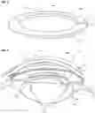 Fig. 03 - Devices and methods for creating a capsulorhexis