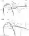 Fig. 16 - Devices and methods for creating a capsulorhexis