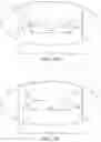 Fig. 07 - PANT-TYPE WEARABLE ARTICLE