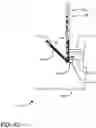 Fig. 13 - Mountable elevator