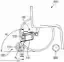 Fig. 01 - Auxiliary drive device for a wheelchair