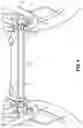 Fig. 05 - Rotatable swing arm stabilizer for folding wheelchairs