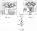 Fig. 19 - Integrated operating room lighting and patient warming system—design and components