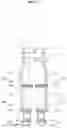 Fig. 17 - Walking assistance method and apparatus