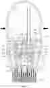 Fig. 08 - Foam generator for inverted compression receptacles