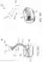Fig. 30 - Pressure field stimulation device having adaptable arm