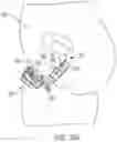 Fig. 40 - Pressure field stimulation device having adaptable arm