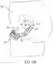 Fig. 41 - Pressure field stimulation device having adaptable arm