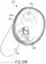 Fig. 48 - Pressure field stimulation device having adaptable arm