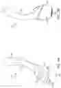 Fig. 31 - Pressure field stimulation device