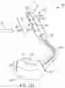 Fig. 23 - Pressure field stimulator having a cup integrated with a sheath