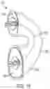 Fig. 30 - Pressure field stimulator having a cup integrated with a sheath