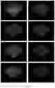 Fig. 12 - Compositions with doped titanium dioxide nanoparticles and methods of use