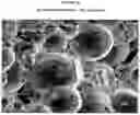 Fig. 11 - Prolonged Release of Local Anesthetics Using Microparticles and Surgery Applications