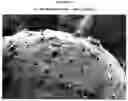 Fig. 13 - Prolonged Release of Local Anesthetics Using Microparticles and Surgery Applications