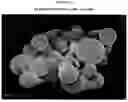 Fig. 14 - Prolonged Release of Local Anesthetics Using Microparticles and Surgery Applications