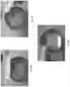 Fig. 11 - Abuse deterrent formulations of amphetamine