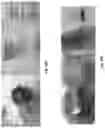 Fig. 15 - Abuse deterrent formulations of amphetamine