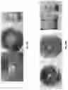 Fig. 17 - Abuse deterrent formulations of amphetamine