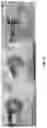 Fig. 20 - Abuse deterrent formulations of amphetamine