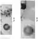 Fig. 21 - Abuse deterrent formulations of amphetamine