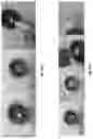 Fig. 25 - Abuse deterrent formulations of amphetamine