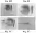 Fig. 40 - Abuse deterrent formulations of amphetamine