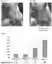 Fig. 06 - Reduction of adipose tissue