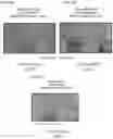 Fig. 08 - Reduction of adipose tissue